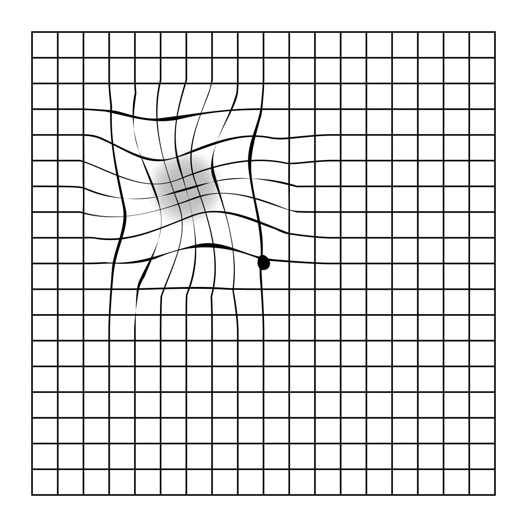 Amsler Grid Eye Test Sheet Template